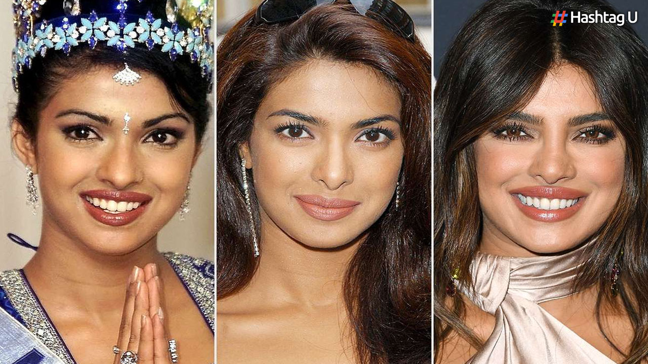 Priyanka Chopra opens up about botched nose surgery and its impact on her career