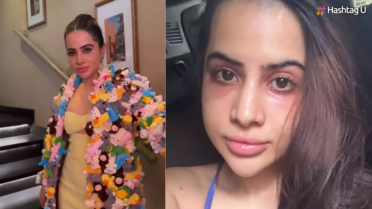 Urfi Javed Opens Up About Her Lip Filler Journey