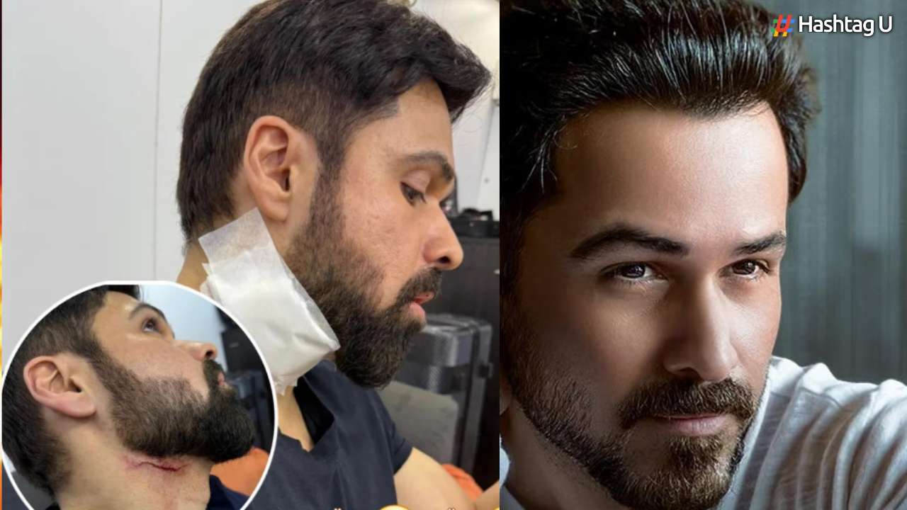 Emraan Hashmi Injured While Shooting for Goodachari 2 in Hyderabad